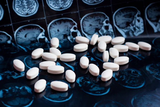 磁気脳共鳴スキャン mri の背景に医薬品薬の丸薬。薬局のテーマ、ヘルスケア、腫瘍のための薬物処方、アルツハイマー、精神疾患治療薬 - brain mri scan alzheimers disease medical scan ストックフォトと画像