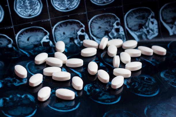 pharmaceutical medicine pills on magnetic brain resonance scan mri background. pharmacy theme, health care, drug prescription for tumor, alzheimer, mental illness treatment medication - brain mri scan alzheimers disease medical scan imagens e fotografias de stock