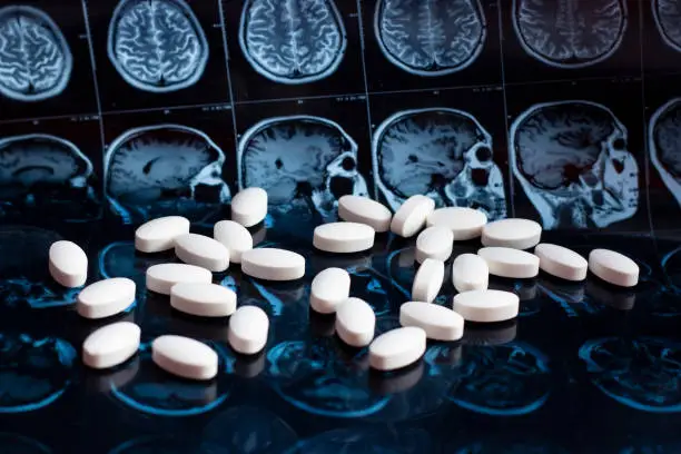 White pharmaceutical medicine pills on magnetic brain resonance scan mri background. Pharmacy theme, health care, drug prescription for tumor, alzheimer, mental illness treatment medication