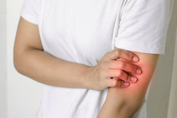 istock Woman with pain in arm. 1140165144