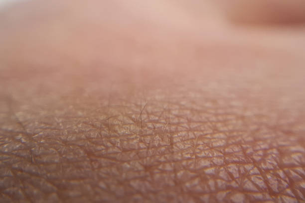 istock Macro skin of human hand 1140175737