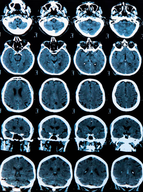 cerebro humano - phase image mri scan science nobody fotografías e imágenes de stock