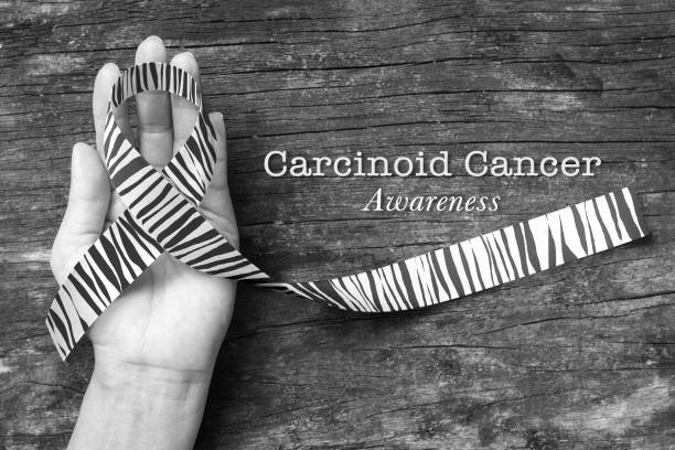 Carcinoid Cancer Awareness ribbon zebra stripe pattern on helping hand Carcinoid Cancer Awareness ribbon zebra stripe pattern on helping hand beast cancer awareness month stock pictures, royalty-free photos & images