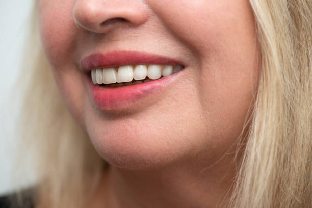istock Senior Woman 1140289789
