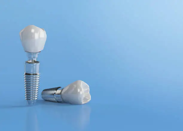 Photo of Dental implant close-up and isolated on blue background with copy space. 3d illustration. artificial tooth root that embed in the bone of the jaw to support artificial crown.