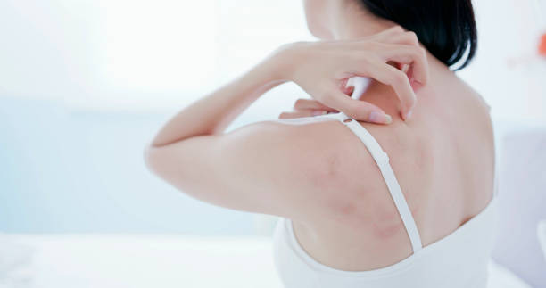 woman scratching shoulder and neck stock photo