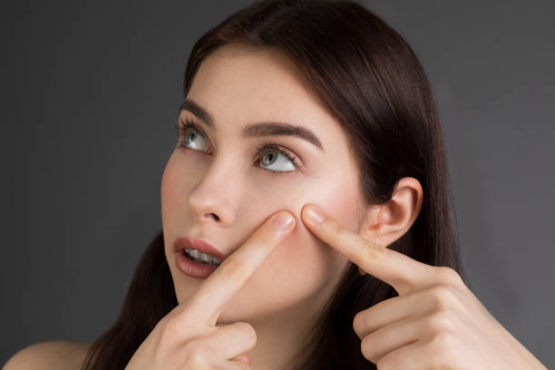 istock Young woman squeezing her pimple, removing pimple from her face 1140454543