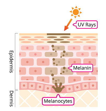 ultraviolet rays overproduced melanin is accumulated and it appears as dark spots