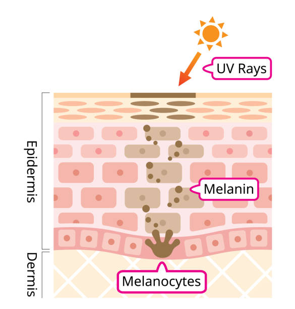 skin mechanism of melanin and facial dark spots. Infographic human skin illustration. Beauty and skin care concept ultraviolet rays overproduced melanin is accumulated and it appears as dark spots epidermal cell stock illustrations