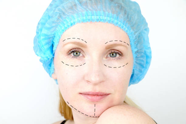 istock Facial plastic surgery or facelift, facelift, face correction. A plastic surgeon examines a patient before plastic surgery. 1140637885