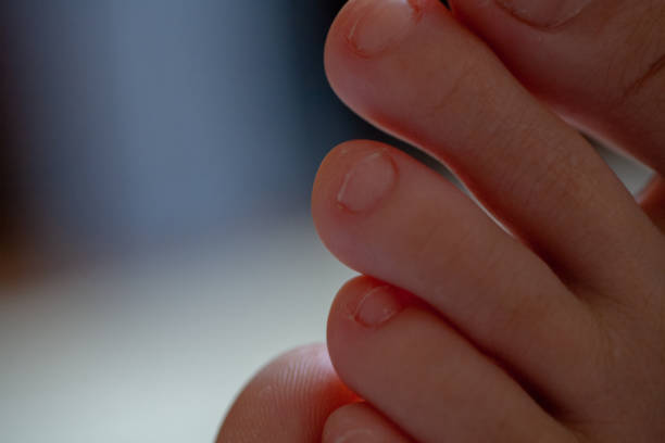 istock Men's toes, healthy toe nails 1140666061