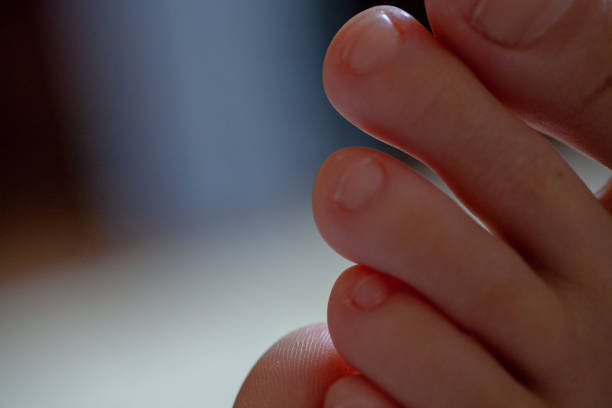 young girl's toes are healthy and beautiful. Well-groomed toes. Concept for medical articles and ointments - the image of the toes and feet. Image of legs with space for inscriptions and advertising.