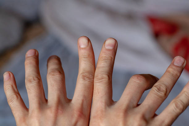 istock Finger of seniors have problems trigger fingers 1140756117