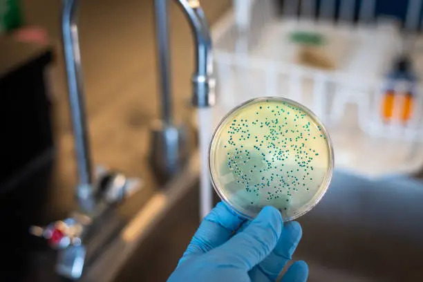 Photo of E. coli or coliform bacteria isolated and culture from running supply water