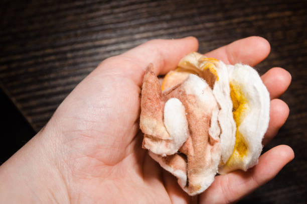 istock Cotton pads in the hand 1140835703