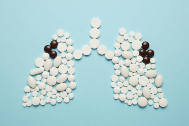 istock Sick person's lungs from pills, contagious tuberculosis 1140921718