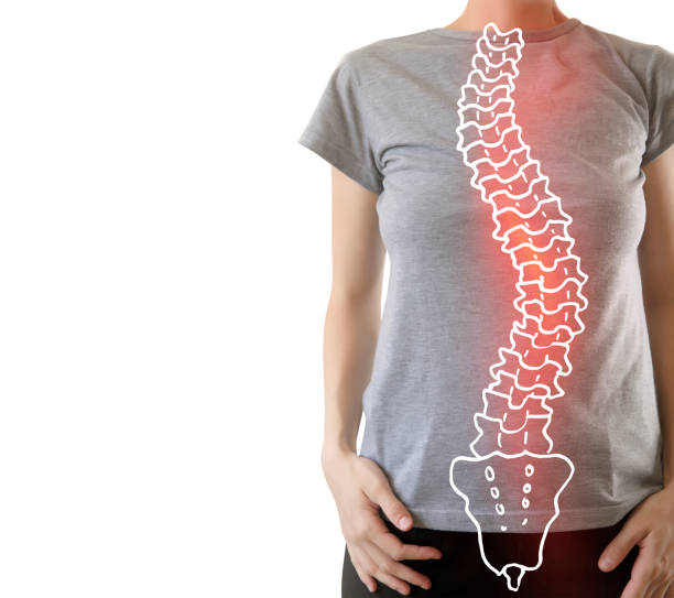 uszkodzony kręgosłup ludzki ze skoliozą o wysokim rozsłonce - objaw bólu - brain physical injury x ray image x ray zdjęcia i obrazy z banku zdjęć