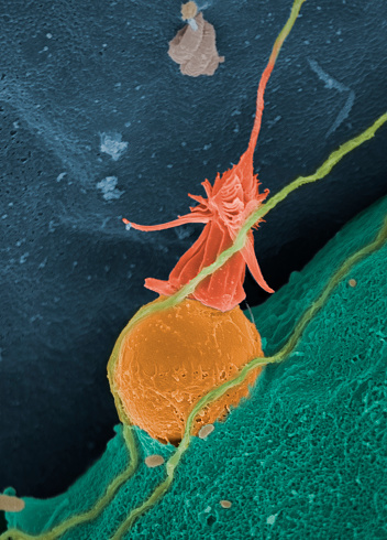 A nematocyst darting from a hydroid (Ectopleura larynx) with explosive force. Ectopleura larynx is a marine animal usually found attached to sunken ropes, floating buoys, mussel shells, rocks and seaweed. Like jellyfish, it is armed with stinging cells equipped with nematocysts used to capture and subdue prey. The hydroid nematocysts are not harmful to humans, as the stinger cannot penetrate sufficiently into human skin to inflict any harm. Coloured scanning electron micrograph (SEM) magnified x3875 when printed at 10cm wide.