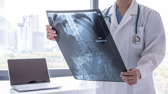 Stomach x-ray film image with doctor for medical and radiological diagnosis on female patient's health on abdominal disease and bone cancer illness, healthcare hospital service concept