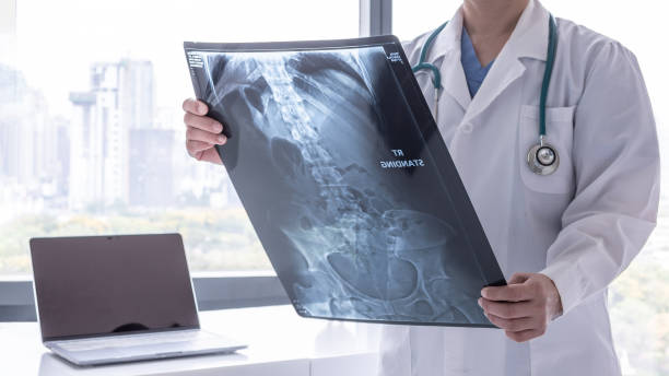 stomach x-ray film image with doctor for medical and radiological diagnosis on female patient's health on abdominal disease and bone cancer illness, healthcare hospital service concept - cancro gástrico imagens e fotografias de stock