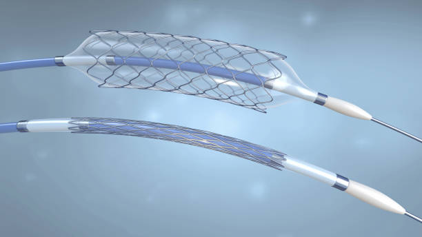 stent und katheter für die implantation und unterstützung der durchblutung in die blutgefäße mit einem leeren und gefüllten ballon-3d-abbildung - angioplasty stock-fotos und bilder