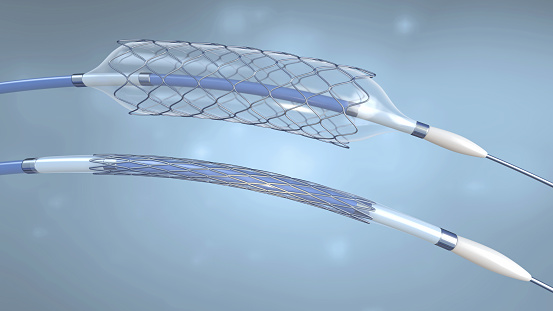 Stent and catheter for implantation into blood vessels with an empty and filled balloon - 3d illustration