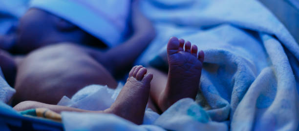 bébé nouveau-né couché sous la lampe bleue en raison de la bilirubine, photothérapie, il a ictère - yellowing photos et images de collection