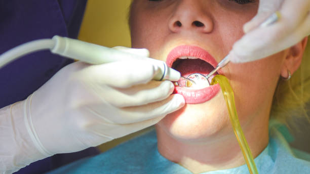 istock Checking and polishing teeth in a dentist 1141290300