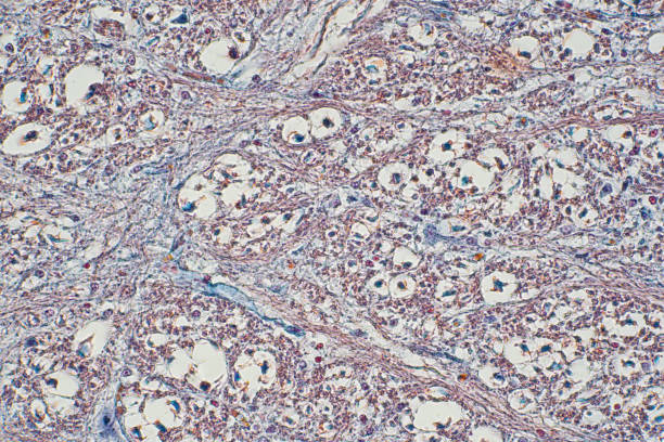 istock Cross section of spinal cord under the microscope view. Histological for human physiology. 1141319716