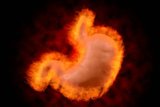 Photo of Acute abdominal pain, heartburn and indigestion, peptic ulcer and painful gastrointestinal ache concept theme with a stomach engulfed in fire flames