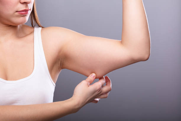 8,600+ Flabby Arms Stock Photos, Pictures & Royalty-Free Images - iStock