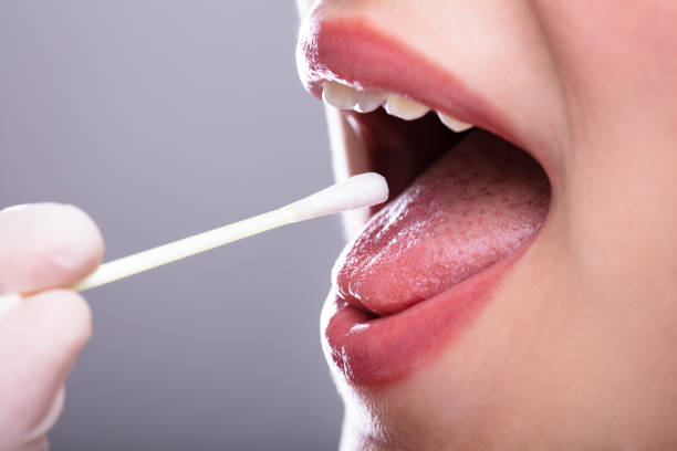 istock Dentist's Hand Taking Saliva Test From Woman's Mouth 1141353783