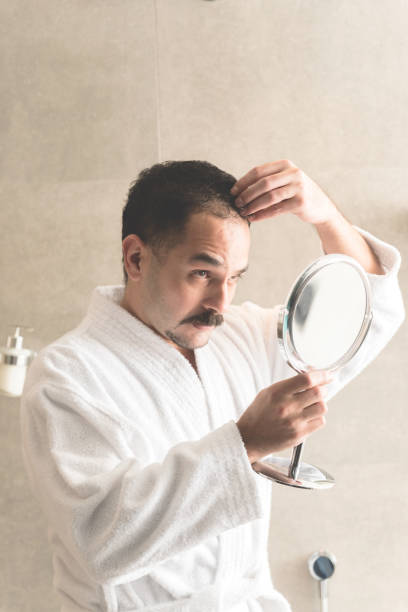 istock Man having hair loss 1141388951
