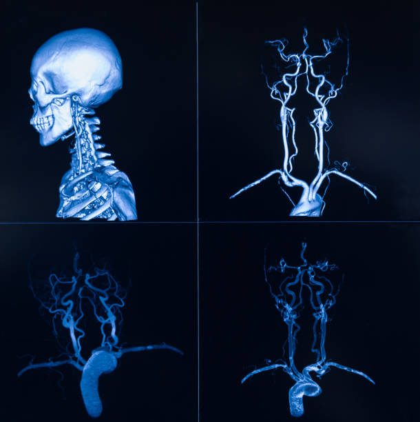 tc/raggi x/risonanza ta esame completo del corpo - mri scan cat scan machine x ray brain foto e immagini stock