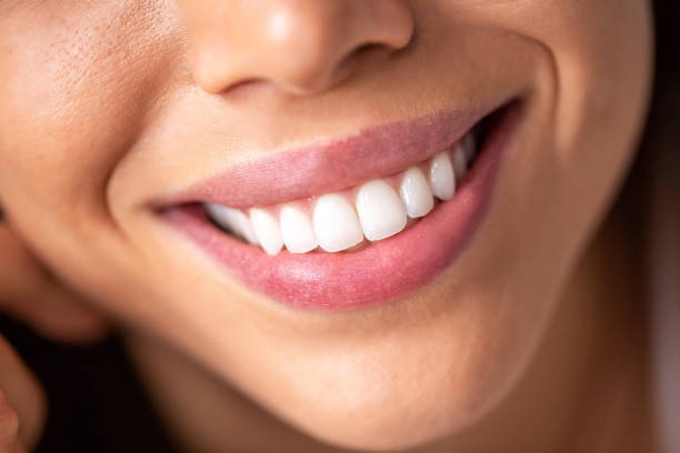 istock Close up of a beautiful smile with shining white teeth 1141445851