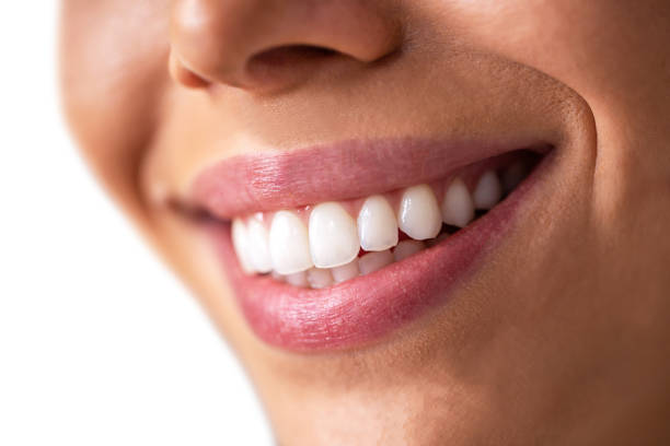 istock Close up of a beautiful smile with shining white teeth 1141447106