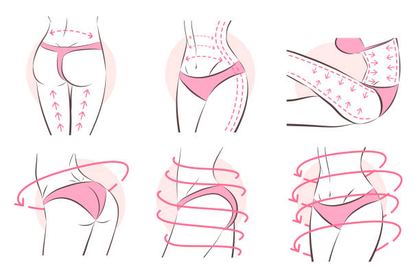 ilustrações de stock, clip art, desenhos animados e ícones de surgical lines on woman's body - 180°