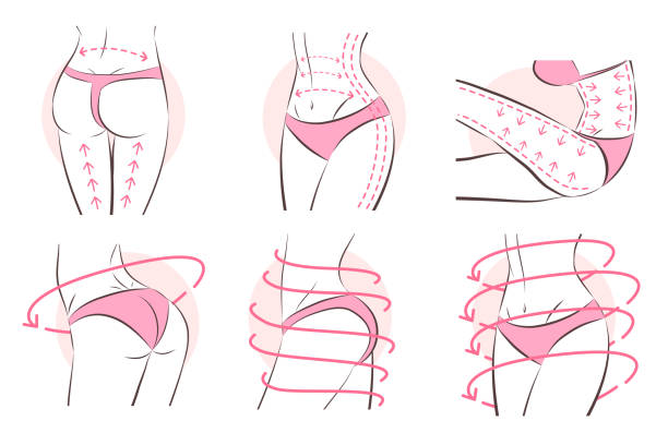 Surgical lines on woman's body Surgical lines for liposuction on beautiful woman body slim woman body stock illustrations