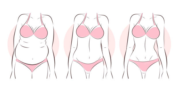 kobieta przed i po liposukcji - makeover series stock illustrations