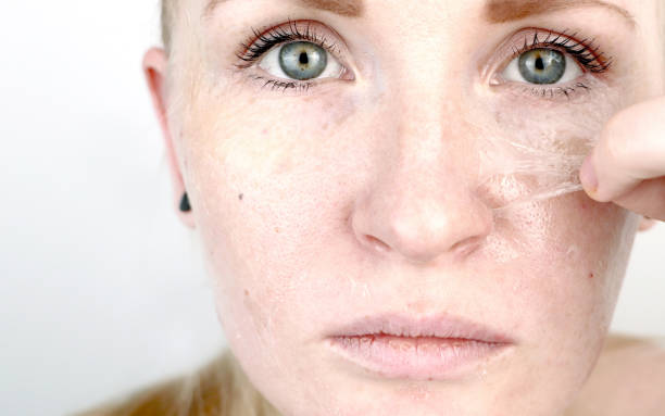 dziewczyna usuwa folię maskową z twarzy. koncepcja usuwania starej suchej skóry, samoopieki - human skin dry human face peeling zdjęcia i obrazy z banku zdjęć