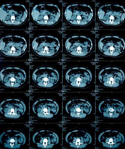 radiografia cerebrale - mri scan cat scan machine x ray brain foto e immagini stock