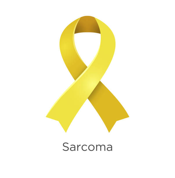 istock Sarcoma awareness month in July. A sarcoma is a cancer that arises from transformed cells of mesenchymal origin. Yellow color ribbon Cancer Awareness Products. Vector illustration. White isolated. 1141663980