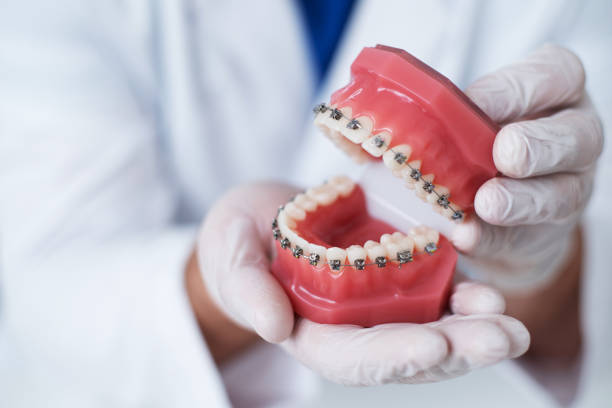 doktor ortodontist dişler üzerinde parantez sisteminin nasıl düzenlendiği gösterir - diş telleri stok fotoğraflar ve resimler
