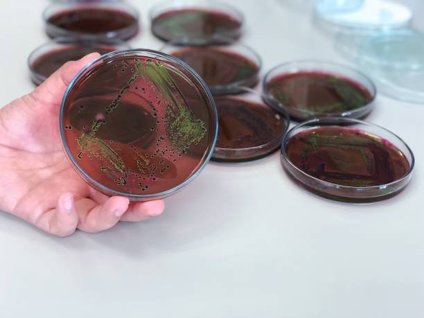 Escherichia coli (E.coli) cultured with Eosin Methylene Blue (EMB) Agar in Petri dish show the metallic green sheen colonies using Biological safety cabinets in medical health lab for analysis disease. escherichia coli (e. coli) cultivada con agar eosina azul de metileno (emb) en placa de petri muestran las colonias de brillo verde metálico utilizando gabinetes de seguridad biológica en el laboratorio de salud médica para la enfermedad de análisis