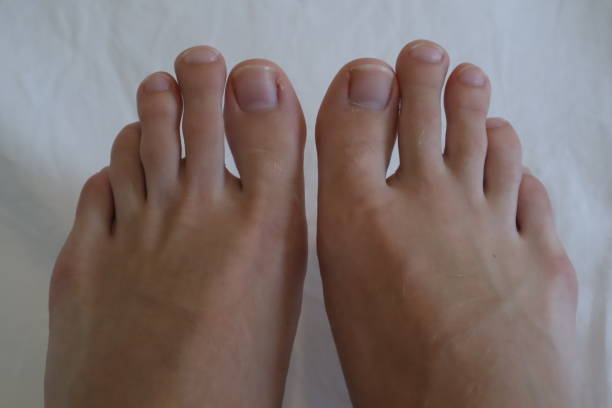 istock Clean male toes without any dermatological issues on white background. 1141741099