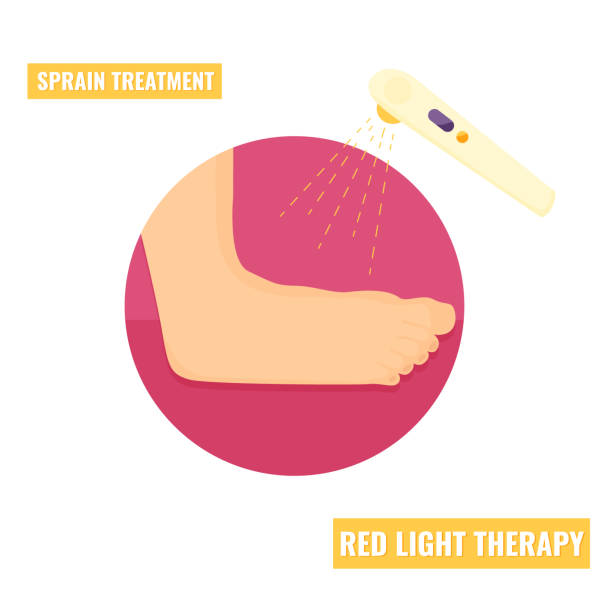 илустрация деформации лодыжки. значок травмы кости. лечение терапии красным светом - twisted ankle stock illustrations