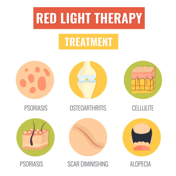 illustrazioni stock, clip art, cartoni animati e icone di tendenza di trattamento di terapia a luci rosse. set di icone con diversi problemi di salute. - laser therapy medical laser light therapy