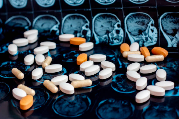 фармацевтическая медицина таблетки на магнитно-резонансном томографии мозга мрт фон. тема аптеки, здравоохранение, рецепт на лекарства от  - brain mri scan alzheimers disease medical scan стоковые фото и изображения