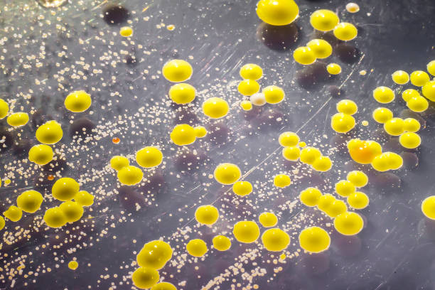 皮膚塗抹から成長した細菌、ミクロコッカス luteus および表皮ブドウ球菌のコロニー - staphylococcus epidermidis ストックフォトと画像
