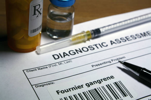 istock Fournier gangrene treatment 1142092613
